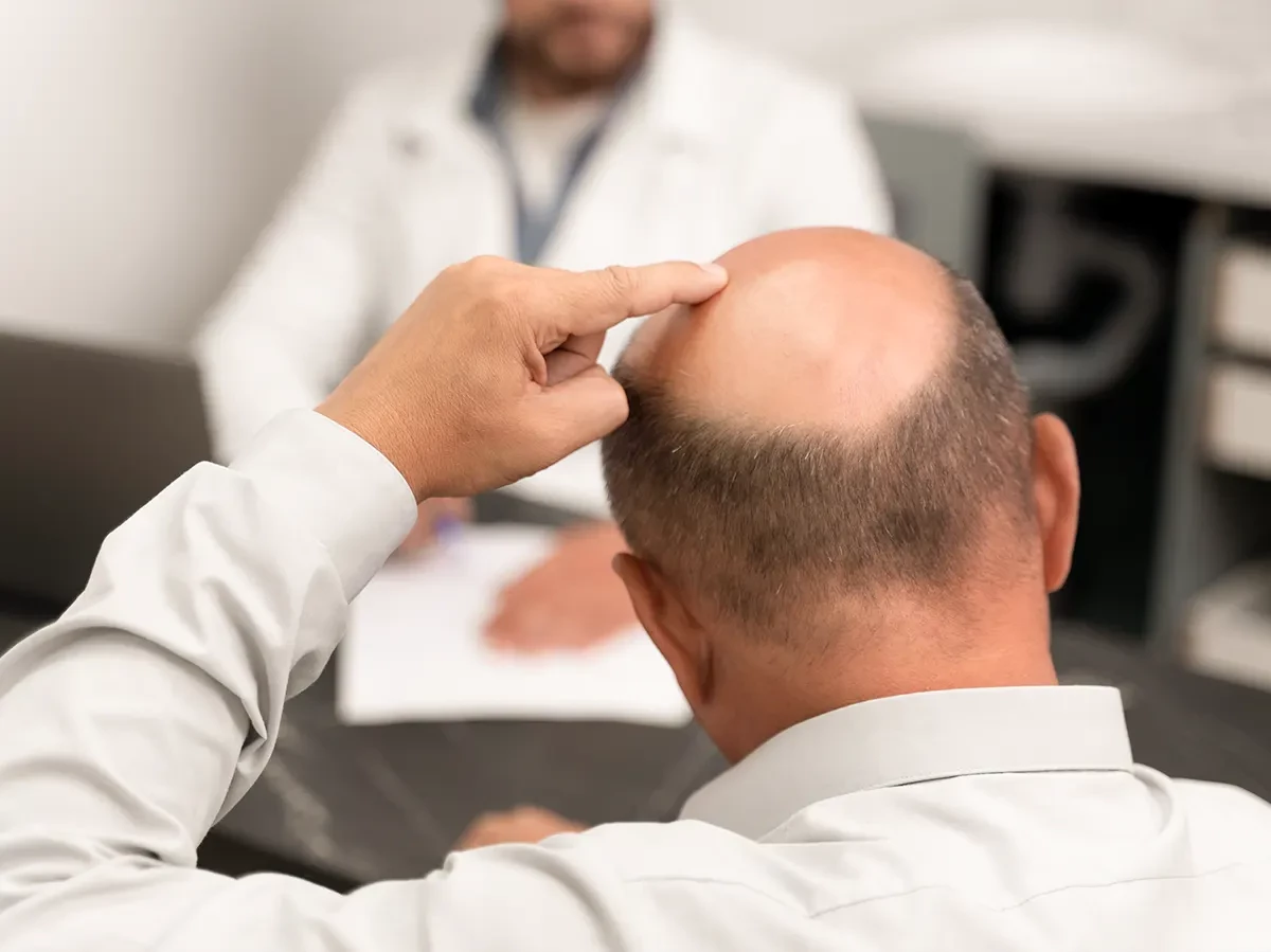 Đàn ông hói đầu có liên quan tới vấn đề sinh lý hay không? 👴